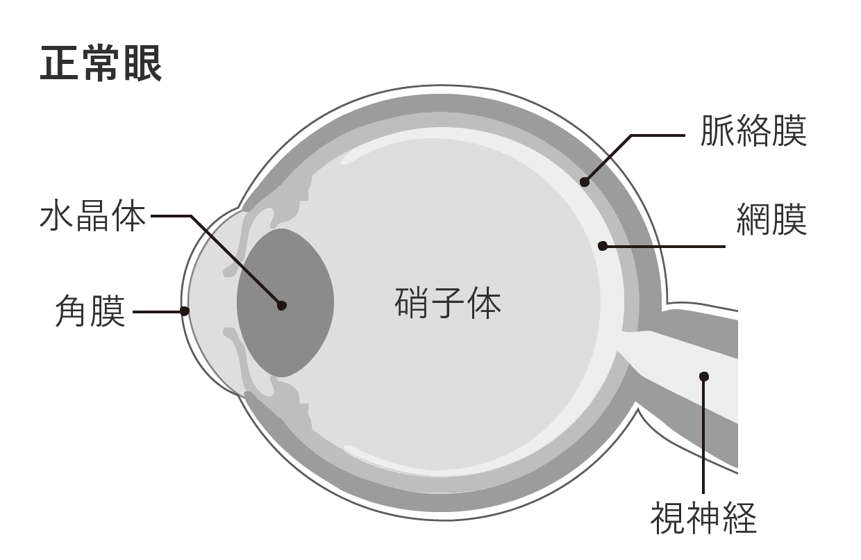 正常眼